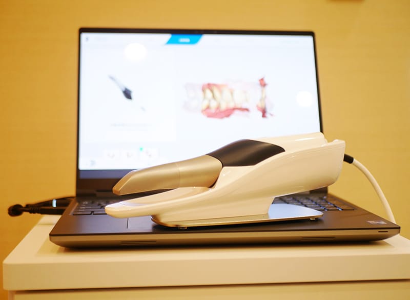 3D光学スキャナー