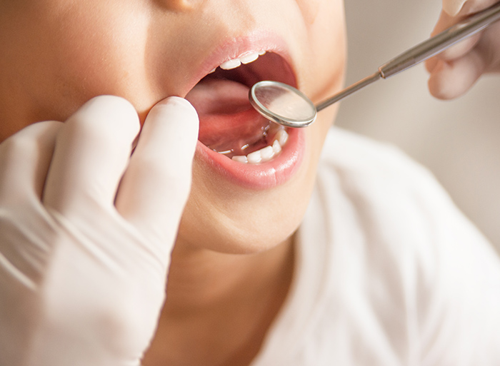 「お口ポカン」になっていませんか？