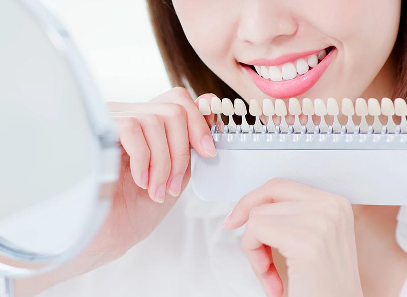 ホワイトニング